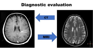 Diagnostic evaluation
CT
MRI
 