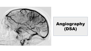 Angiography
(DSA)
 