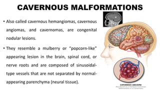 CAVERNOUS MALFORMATIONS
• Also called cavernous hemangiomas, cavernous
angiomas, and cavernomas, are congenital
nodular lesions.
• They resemble a mulberry or “popcorn-like”
appearing lesion in the brain, spinal cord, or
nerve roots and are composed of sinusoidal-
type vessels that are not separated by normal-
appearing parenchyma (neural tissue).
 