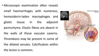 • Microscopic examination often reveals
small haemorrhages with numerous,
hemosiderin-laden macrophages and
gliotic tissue in the adjacent
parenchyma. Elastic fibres are absent in
the walls of these vascular caverns.
Thrombosis may be present in some of
the dilated venules. Calcification within
the lesion is common.
 