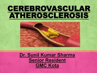CEREBROVASCULAR
ATHEROSCLEROSIS
Dr. Sunil Kumar Sharma
Senior Resident
GMC Kota
 