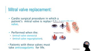 Mitral valve replacement:
• Cardio surgical procedure in which a
patient’s mitral valve is replaced by a prosthetic
valve.
• Performed when the:
• (mitral valve stenosis)
• (mitral valve regurgitation).
• Patients with these valves must
take anticoagulants for life. TUESDAY 8/9/2016
 