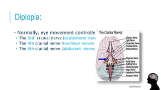 Diplopia:
• Normally, eye movement controlled by :
• The 3rd cranial nerve (oculomotor nerve)
• The 4th cranial nerve (trochlear nerve)
• The 6th cranial nerve (abducent nerve)
TUESDAY 8/9/2016
 