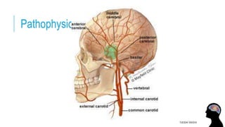 Pathophysiology of diplopia:
TUESDAY 8/9/2016
 