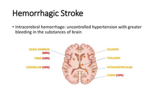 Hemorrhagic Stroke
• Intracerebral hemorrhage: uncontrolled hypertension with greater
bleeding in the substances of brain
 