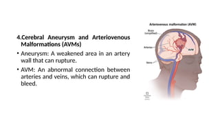 Cerebrovascular disease by Sujit .pptx