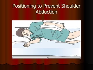 Positioning to Prevent Shoulder Abduction 
