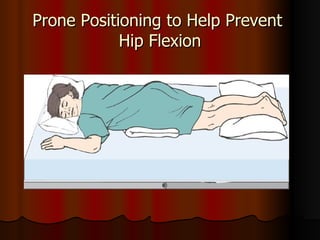 Prone Positioning to Help Prevent  Hip Flexion 