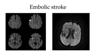 Cerebrovascular diseases Cerebrovascular diseases ofCognitive and ...