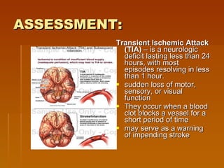 ASSESSMENT:   Transient Ischemic Attack (TIA)  – is a neurologic deficit lasting less than 24 hours, with most episodes resolving in less than 1 hour. sudden loss of motor, sensory, or visual function  They occur when a blood clot blocks a vessel for a short period of time  may serve as a warning of impending stroke  