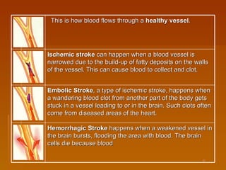    This is how blood flows through a  healthy vessel .     Ischemic stroke  can happen when a blood vessel is narrowed due to the build-up of fatty deposits on the walls of the vessel. This can cause blood to collect and clot.     Embolic Stroke , a type of ischemic stroke, happens when a wandering blood clot from another part of the body gets stuck in a vessel leading to or in the brain. Such clots often come from diseased areas of the heart.     Hemorrhagic Stroke  happens when a weakened vessel in the brain bursts, flooding the area with blood. The brain cells die because blood 