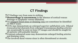 Nect Channel Imaging in Cerebrovascular Malformations | PPT