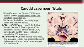 Imaging in Cerebrovascular Malformations | PPT
