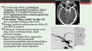 Imaging in Cerebrovascular Malformations | PPT