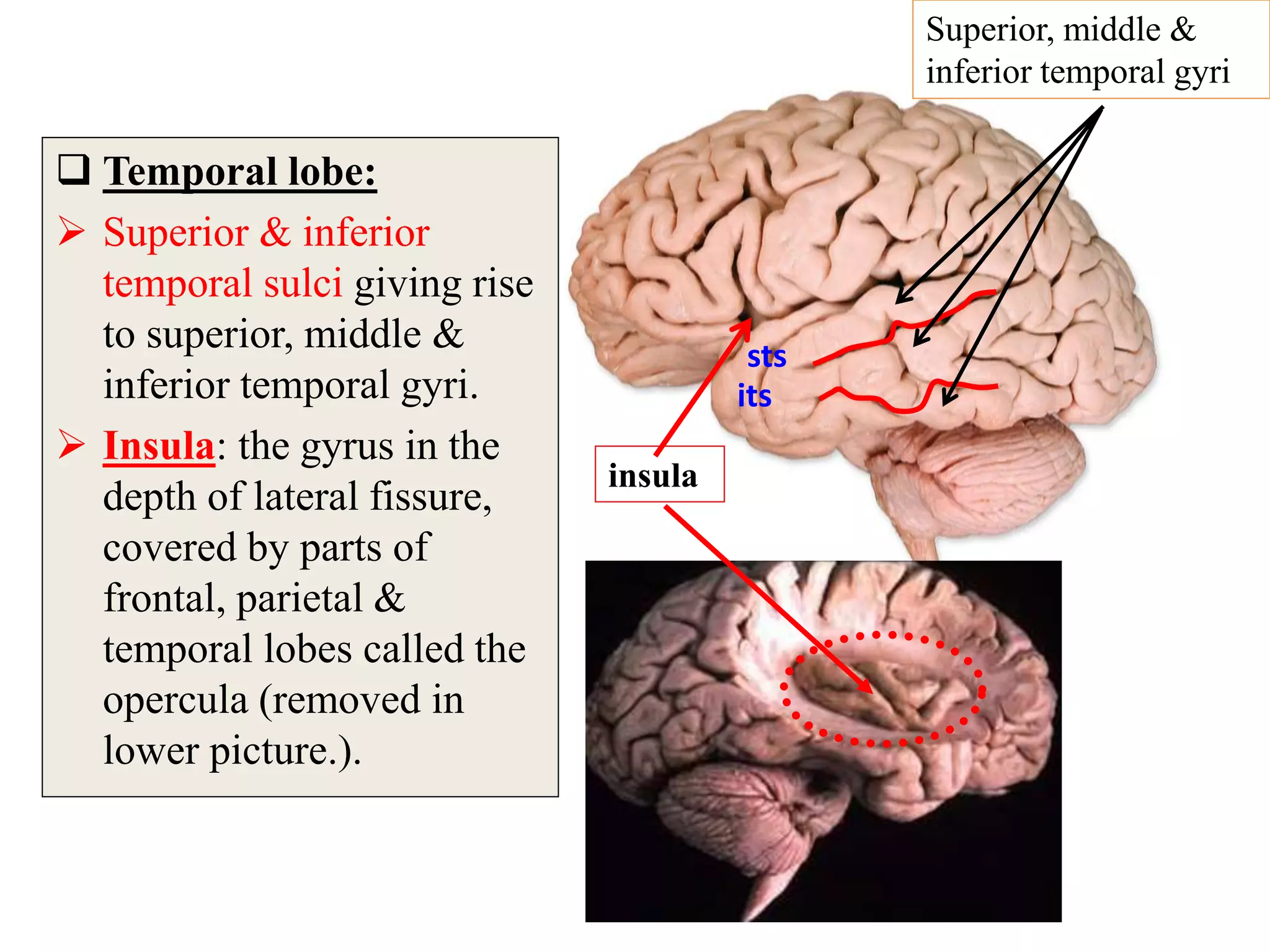  Temporal lobe:
 Superior & inferior
temporal sulci giving rise
to superior, middle &
inferior temporal gyri.
 Insula: the gyrus in the
depth of lateral fissure,
covered by parts of
frontal, parietal &
temporal lobes called the
opercula (removed in
lower picture.).
Superior, middle &
inferior temporal gyri
insula
sts
its
 