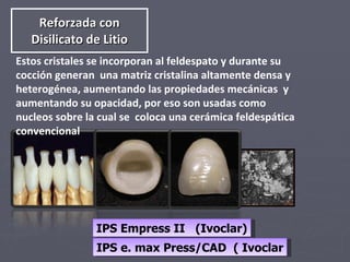 Reforzada con Disilicato de Litio Estos cristales se incorporan al feldespato y durante su cocción generan  una matriz cristalina altamente densa y heterogénea, aumentando las propiedades mecánicas  y aumentando su opacidad, por eso son usadas como nucleos sobre la cual se  coloca una cerámica feldespática  convencional IPS Empress II  (Ivoclar) IPS e. max Press/CAD  ( Ivoclar 