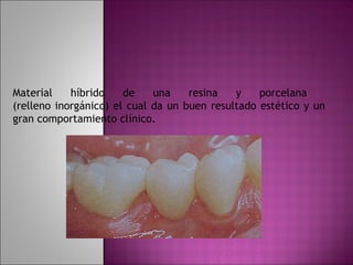 Material    híbrido    de    una    resina   y    porcelana
(relleno inorgánico) el cual da un buen resultado estético y un
gran comportamiento clínico.
 