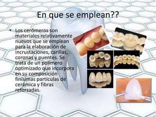 En que se emplean??
• Los cerómeros son
  materiales relativamente
  nuevos que se emplean
  para la elaboración de
  incrustaciones, carillas,
  coronas y puentes. Se
  trata de un polímero
  optimizado que incorpora
  en su composición
  finísimas partículas de
  cerámica y fibras
  reforzadas.
 