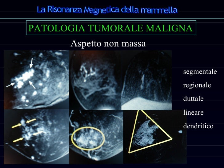 Ho Fatto Una Risonanza Con Contrasto E Sono Incinta