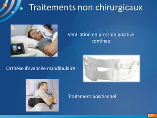 10
Traitements non chirurgicaux
Ventilation en pression positive
continue
Orthèse d’avancée mandibulaire
Traitement positionnel
 