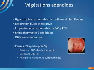 • Hypertrophie responsable de ronflement chez l’enfant
• Respiration buccale exclusive
• En général non responsable de SAS / PG?
• Rhinopharyngites à répétition
• Otite séro-muqueuse
• Causes d’hypertrophie Vg:
• Penser au RGO chez le tout petit
• infections ORL +++
• Allergie > 5-6 ans (mais surtout rhinite)
11
Végétations adénoïdes
 