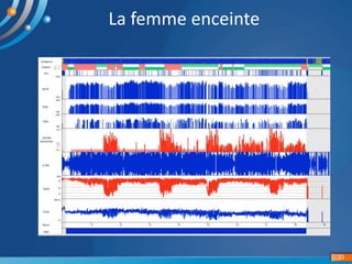 23
La femme enceinte
 