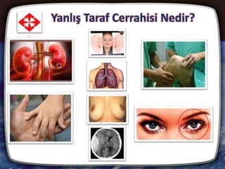 Yanlış Taraf Cerrahisi Nedir?
10
 