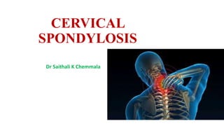 CERVICAL
SPONDYLOSIS
Dr Saithali K Chemmala
 
