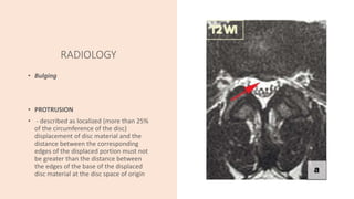 Cervical Spondylosis | PPTX