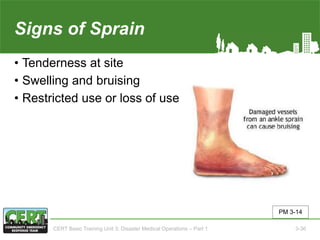 Signs of Sprain
• Tenderness at site
• Swelling and bruising
• Restricted use or loss of use
PM 3-14
CERT Basic Training Unit 3: Disaster Medical Operations – Part 1 3-36
 