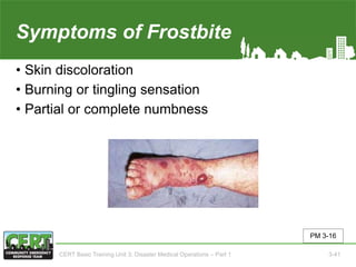 Symptoms of Frostbite
• Skin discoloration
• Burning or tingling sensation
• Partial or complete numbness
PM 3-16
CERT Basic Training Unit 3: Disaster Medical Operations – Part 1 3-41
 
