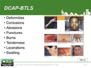 DCAP-BTLS
• Deformities
• Contusions
• Abrasions
• Punctures
• Burns
• Tenderness
• Lacerations
• Swelling
PM 4-8
CERT Basic Training Unit 4: Disaster Medical Operations – Part 2 4-13
 