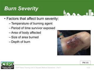 Burn Severity
• Factors that affect burn severity:
‒ Temperature of burning agent
‒ Period of time survivor exposed
‒ Area of body affected
‒ Size of area burned
‒ Depth of burn
PM 3-9
CERT Basic Training Unit 3: Disaster Medical Operations – Part 1 3-23
 