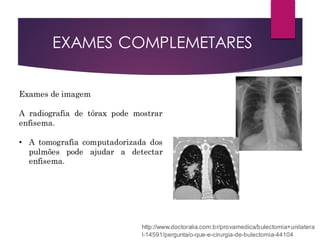 Exames de imagem
A radiografia de tórax pode mostrar
enfisema.
• A tomografia computadorizada dos
pulmões pode ajudar a detectar
enfisema.
http://www.doctoralia.com.br/provamedica/bulectomia+unilatera
l-14591/pergunta/o-que-e-cirurgia-de-bulectomia-44104
EXAMES COMPLEMETARES
 