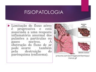 FISIOPATOLOGIA
 Limitação do fluxo aéreo
é progressiva e está
associada a uma resposta
inflamatória anormal dos
pulmões a partículas ou
gases nocivos. A
obstrução do fluxo de ar
pode ocorre também
pela destruição do
parênquima (enfisema). fonte:
pneumo.com.br/images/enfisemapul
monar.gif
 