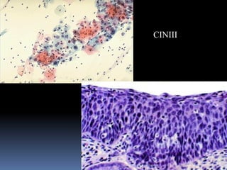 CINIII
CINIII
Aboubakr Elnashar
 