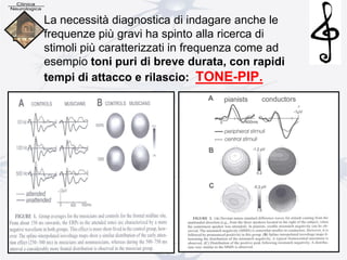 La necessità diagnostica di indagare anche le
frequenze più gravi ha spinto alla ricerca di
stimoli più caratterizzati in frequenza come ad
esempio toni puri di breve durata, con rapidi
tempi di attacco e rilascio: TONE-PIP.
 
