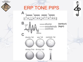 ERP TONE PIPS
(tamburi)
(legni)
 