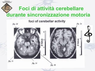 Foci di attività cerebellare
durante sincronizzazione motoria
ritmica
 