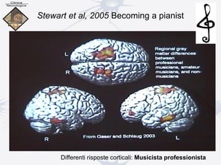 Stewart et al, 2005 Becoming a pianist
Differenti risposte corticali: Musicista professionista
 
