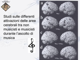 Studi sulle differenti
attivazioni delle aree
cerebrali tra non
musicisti e musicisti
durante l’ascolto di
musica
 