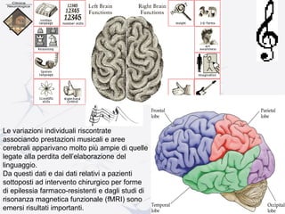 Le variazioni individuali riscontrate
associando prestazioni musicali e aree
cerebrali apparivano molto più ampie di quelle
legate alla perdita dell’elaborazione del
linguaggio.
Da questi dati e dai dati relativi a pazienti
sottoposti ad intervento chirurgico per forme
di epilessia farmaco-resistenti e dagli studi di
risonanza magnetica funzionale (fMRI) sono
emersi risultati importanti.
 
