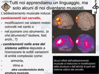 Tutti noi apprendiamo un linguaggio, ma
solo alcuni di noi diventano musicisti.
L’addestramento musicale induce:
cambiamenti nel cervello,
- modificazioni nei sistemi motori
coinvolti nel canto o
- nel suonare uno strumento, (e
che strumento? tastiere, fiati,
archi,..?)
- cambiamenti nelle aree del
sistema uditivo deputate a
riconoscere le sottili variazioni
di entità complesse come:
- armonia,
- ritmo e
- altre caratteristiche della
struttura musicale.
Alcuni effetti dell’addestramento
musicale si traducono in modificazioni
della struttura o dell’attività di parti del
sistema uditivo del cervello.
 