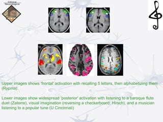 Upper images shows 'frontal' activation with recalling 5 letters, then alphabetizing them
(Rypma).
Lower images show widespread 'posterior' activation with listening to a baroque flute
duet (Zatorre), visual imagination (reversing a checkerboard; Hirsch), and a musician
listening to a popular tune (U Cincinnati)
 