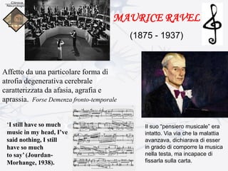 MAURICE RAVEL
(1875 - 1937)
Affetto da una particolare forma di
atrofia degenerativa cerebrale
caratterizzata da afasia, agrafia e
aprassia. Forse Demenza fronto-temporale
‘I still have so much
music in my head, I’ve
said nothing, I still
have so much
to say’ (Jourdan-
Morhange, 1938).
Il suo “pensiero musicale” era
intatto. Via via che la malattia
avanzava, dichiarava di esser
in grado di comporre la musica
nella testa, ma incapace di
fissarla sulla carta.
 