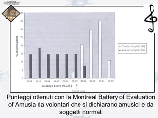 Punteggi ottenuti con la Montreal Battery of Evaluation
of Amusia da volontari che si dichiarano amusici e da
soggetti normali
 