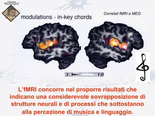 L’fMRI concorre nel proporre risultati che
indicano una considerevole sovrapposizione di
strutture neurali e di processi che sottostanno
alla percezione di musica e linguaggio.
Correlati fMRI e MEG
 
