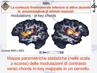 Mappe parametriche statistiche (nella scala
z-scores) delle modulazioni di contrasto
verso chords in-key mappate in un cervello.
fMRI
La corteccia frontolaterale inferiore si attiva durante
la processazione di stimoli musicali
Correlati fMRI e MEG
 