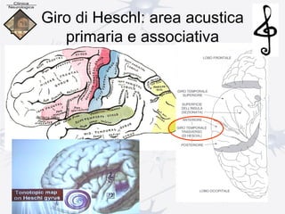 Giro di Heschl: area acustica
primaria e associativa
 