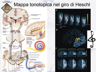 Mappa tonotopica nel giro di Heschl
 